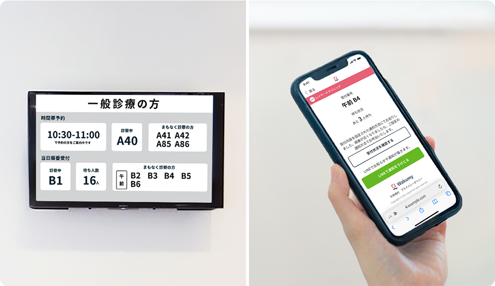 予約システムWakumyの状況表示機能のイメージ